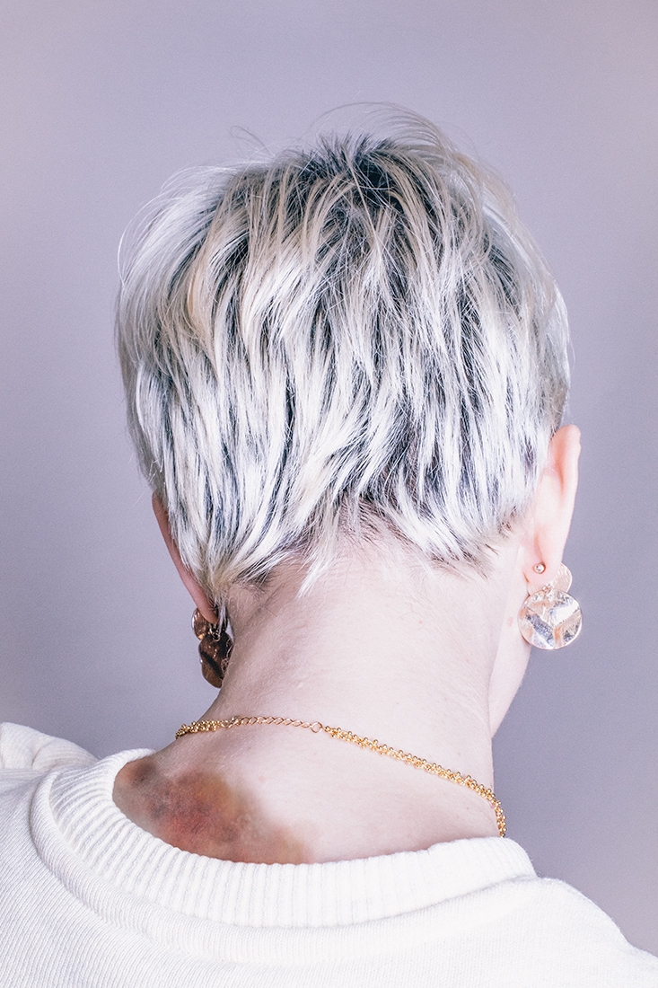 I didn’t fall down the stairs