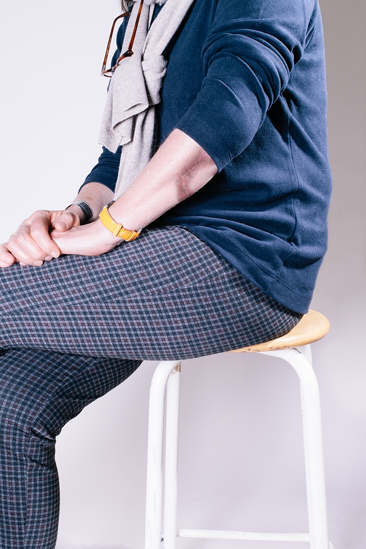 I didn’t fall down the stairs