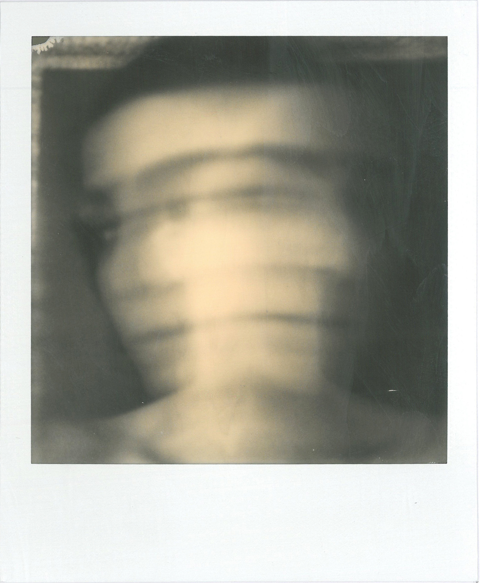 Rupture