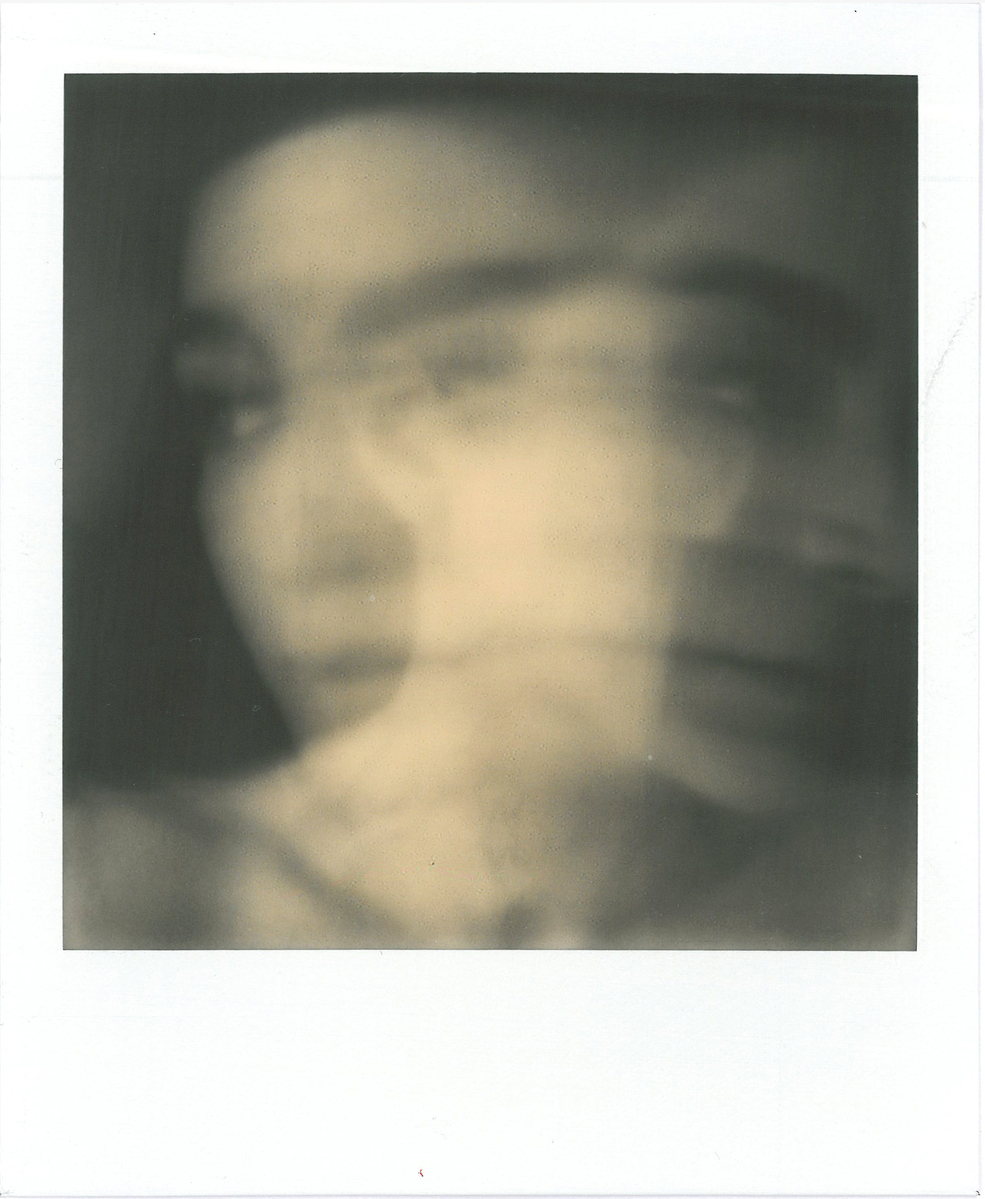 Rupture