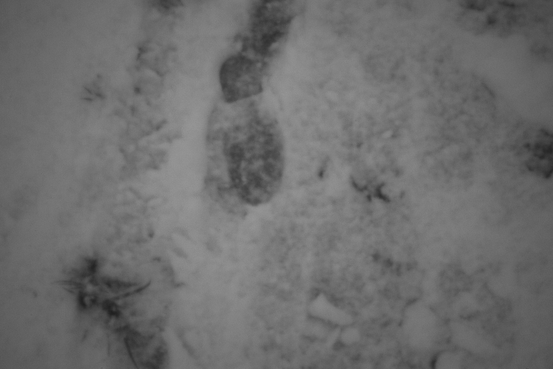 Winter is coming